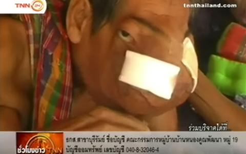 ป่วยเรื้อรัง.jpg